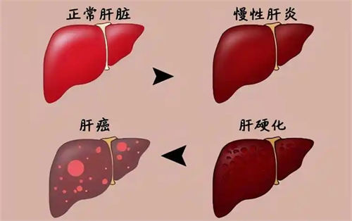 喝了白酒能吃布洛芬吗  3
