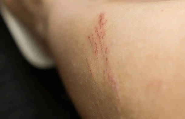 外伤可以喝白酒吗？白酒对外伤有什么影响？