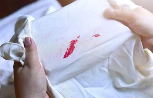 用白酒怎样去血渍？详细处理方法！